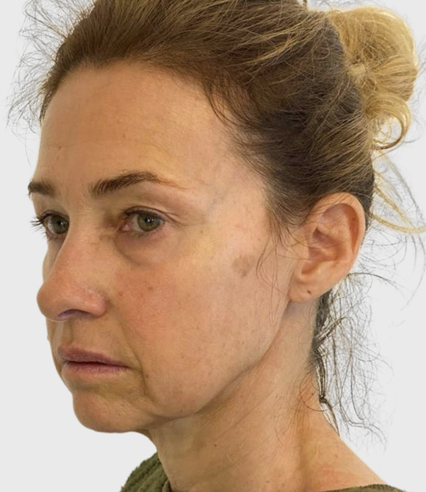 face-before